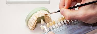 The Role of Dental Labs in Orthodontic Treatment Planning
